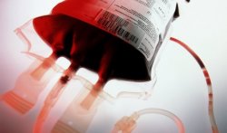 Тарихқа ықпал еткен өнертабыстар: Қан құю