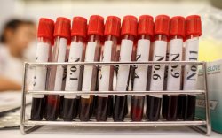 Қан және оның компоненттерін тасымалдау ережелері.