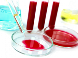 АДАМНЫҢ ОЙЛАУ ҚАБІЛЕТІНЕ КЕРІ ӘСЕР ЕТЕТІН ҚАН ТОБЫ АНЫҚТАЛДЫ